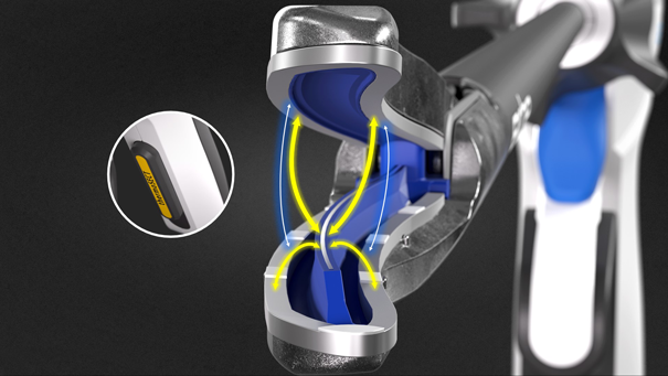 The TriSect rapide® is a fast, electric tripolar dissector that cuts without heat. Three electrodes enable sharp dissection, while two manage coagulation.